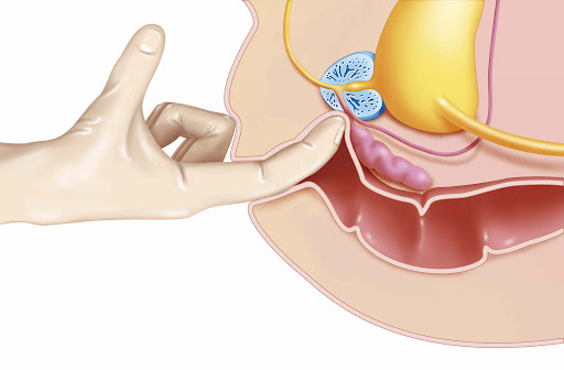 Những phương pháp thủ dâm qua đường hậu môn an toàn cho nam và nữ, vô hại 4 Thứ Năm Roddy 5